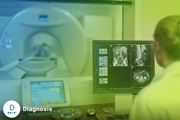 Colon Cancer Diagonosis